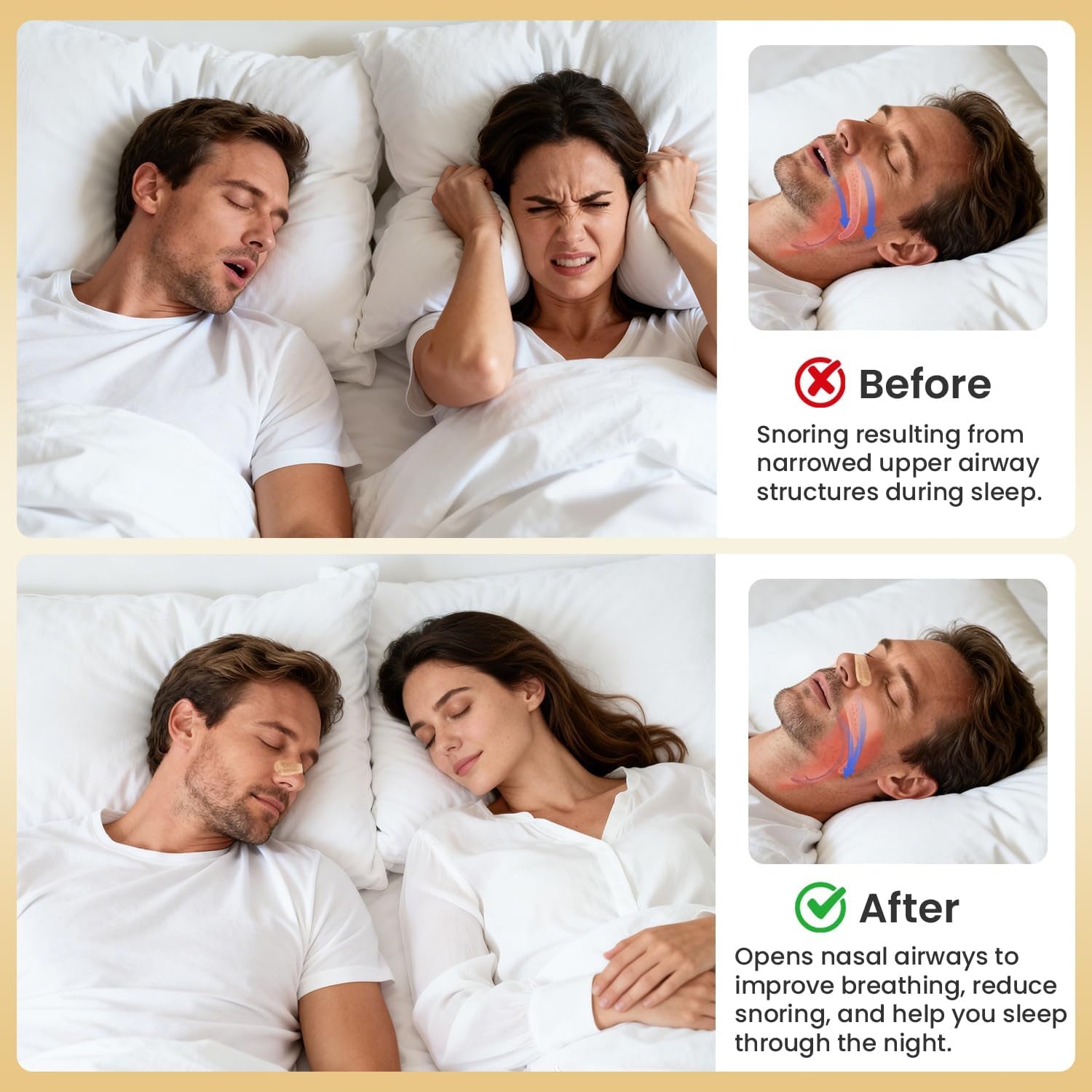 Nasal Strips 100 Count, New Upgraded Softer & Stronger for Snoring Relief, Nose Strips for Breathing, anti Snoring Devices for Sleep & Sports, Help Relieve Nasal Congestion, Deeper Sleep